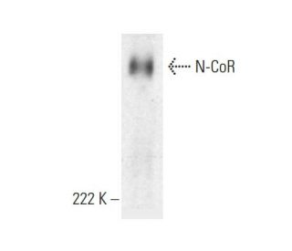 western blotting image from recommended N-CoR (F-1) monoclonal antibody replacement. Image 382026
