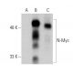 This polyclonal antibody has been discontinued. See our recommended <a href="n-myc-antibody-b8-4-b">N-Myc (B8.4.B)</a> monoclonal antibody (sample data shown). western blotting image from recommended N-Myc (B8.4.B) monoclonal antibody replacement. Image 359551