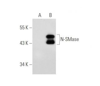 N-SMase Antibody (56-7) - Western Blotting - Image 68314The Double Nickase Plasmid features a U6 promoter for sgRNA expression, a 20 nt targeting sequence, and a gRNA scaffold to guide Cas9n. It includes a CBh promoter for Cas9n (D10A) and puromycin resistance, GFP for transfection verification, and nuclear localization signals (NLS). The 2A peptide allows co-expression of Cas9n and Puro from a single promoter, enabling precise genome editing with reduced off-target effects.