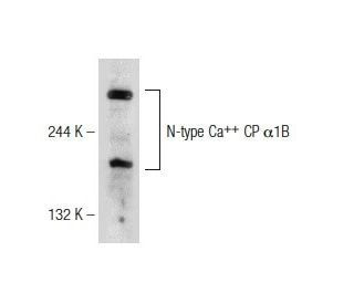 N-type Ca<sup>++</sup> CP &alpha;1B Antibody (A-11) - Western Blotting - Image 146778