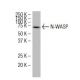 N-WASP Antibody (93-W) - Western Blotting - Image 34331