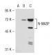 N-WASP Antibody (93-W) - Western Blotting - Image 53513 