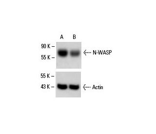 N-WASP siRNA (h): sc-36006. Western blot analysis of N-WASP expression in non-transfected control (A) and N-WASP siRNA tra 
