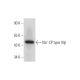 Na+ CP type IIIβ Antibody (C-11) - Western Blotting - Image 344149