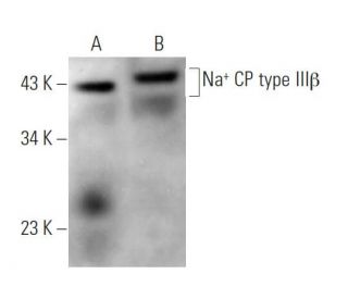 Na<sup>+</sup> CP type III&beta; Antibody (C-11) - Western Blotting - Image 371729 