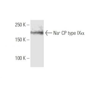 Na<sup>+</sup> CP type IX&alpha; Antibody (5A11) - Western Blotting - Image 347574 