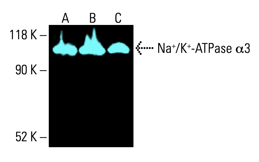 alpha 3 Sodium Potassium ATPase/ATP1A3 Antibody (F-1) | SCBT