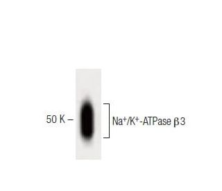 beta 3 Sodium Potassium ATPase/ATP1B3 Antibody (46) - Western Blotting - Image 60373 