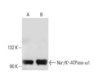 alpha 1 Sodium Potassium ATPase/ATP1A1 Antibody (9-A5) - Western Blotting - Image 14970