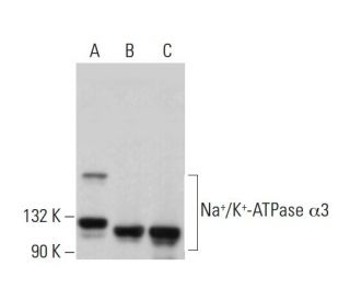 alpha 3 Sodium Potassium ATPase/ATP1A3 Antibody (6D135) - Western Blotting - Image 379989 