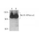 western blotting image from recommended alpha 3 Sodium Potassium ATPase/ATP1A3 (H-4) monoclonal antibody replacement. Image 351984
