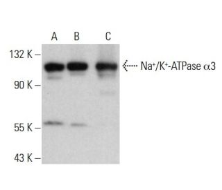 alpha 3 Sodium Potassium ATPase/ATP1A3 Antibody (XVIF9-G10) - Western Blotting - Image 379988 