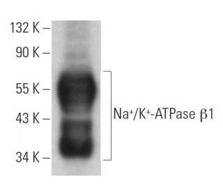 Na<sup>+</sup>/K<sup>+</sup>-ATPase &beta;1 Antibody (6D136) - Western Blotting - Image 379257