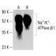 beta 1 Sodium Potassium ATPase/ATP1B1 Antibody (6D136) - Western Blotting - Image 413306
