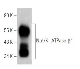Na<sup>+</sup>/K<sup>+</sup>-ATPase &beta;1 Antibody (M17-P5-F11) - Western Blotting - Image 379462 