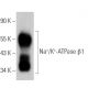 Na+/K+-ATPase β1 Antibody (M17-P5-F11) - Western Blotting - Image 379462 