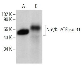 western blotting image from recommended beta 1 Sodium Potassium ATPase/ATP1B1 (E-4) monoclonal antibody replacement. Image 362090