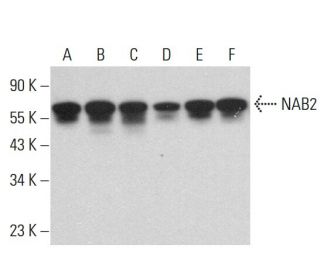 western blotting image from recommended NAB2 (1C4) monoclonal antibody replacement. Image 381935