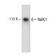 NaBC1 Antibody (5) - Western Blotting - Image 138224 
