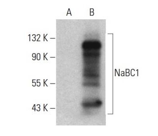NaBC1 Antibody (5) - Western Blotting - Image 399433 