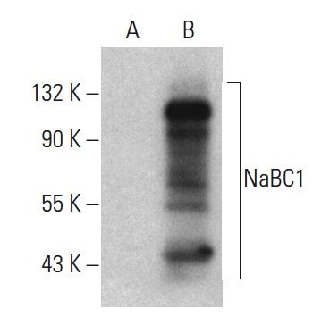 ⭐︎⭐︎⭐︎ nabc1-antibody-5-western-