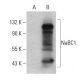NaBC1 Antibody (5) - Western Blotting - Image 399433 