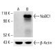 NaBC1 Antibody (5) - Western Blotting - Image 413463