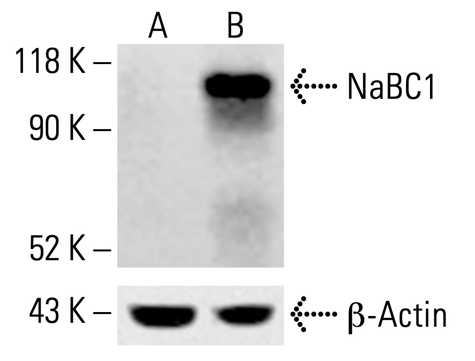 ⭐︎⭐︎⭐︎ NaBC1 Antibody (5) | SCBT - Santa Cruz Biotechnology