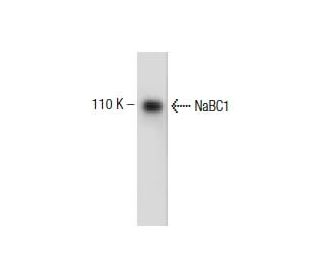 NaBC1 Antibody (5) - Western Blotting - Image 138224Each CRISPR/Cas9 Knockout (KO) Plasmid product consists of a pool of 3 plasmids designed to ensure identification and cleavage of a specific gene for maximum knockout efficiency. Each plasmid encodes a unique 20 nt sequence derived from the GeCKO (v2) library.