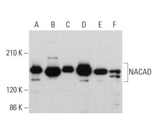 NACAD Antibody (H-4) - Western Blotting - Image 377419 