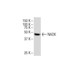 NADK Antibody (J-07) - Western Blotting - Image 33722Each CRISPR/Cas9 Knockout (KO) Plasmid product consists of a pool of 3 plasmids designed to ensure identification and cleavage of a specific gene for maximum knockout efficiency. Each plasmid encodes a unique 20 nt sequence derived from the GeCKO (v2) library.