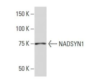 NADSYN1 Antibody (3E3) - Western Blotting - Image 33856