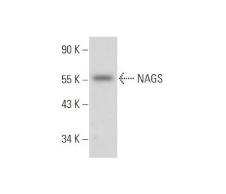 NAGS Antibody (E-8) - Western Blotting - Image 344154Each CRISPR/Cas9 Knockout (KO) Plasmid product consists of a pool of 3 plasmids designed to ensure identification and cleavage of a specific gene for maximum knockout efficiency. Each plasmid encodes a unique 20 nt sequence derived from the GeCKO (v2) library. 