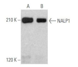 NALP1 Antibody (B-2) - Western Blotting - Image 354648 