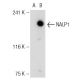 NALP1 Antibody (Nalpy1-4) - Western Blotting - Image 36526