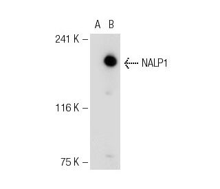 NALP1 Antibody (Nalpy1-4) - Western Blotting - Image 36526 