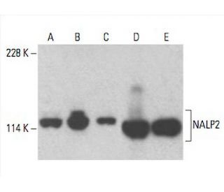 NALP2 Antibody (H-4) - Western Blotting - Image 393049 
