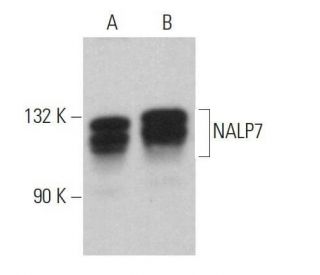 western blotting image from recommended NALP7 (C-8) monoclonal antibody replacement. Image 359053