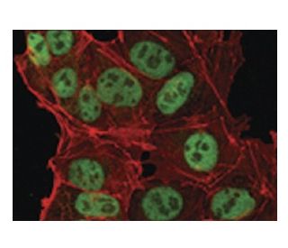 immunofluorescence image from recommended Nanog (1E6C4) monoclonal antibody replacement. Image 137486
