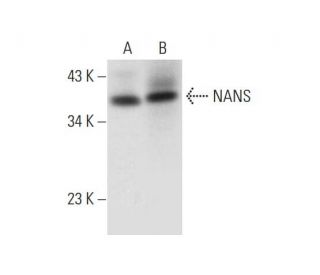 NANS Antibody (B-1) - Western Blotting - Image 314569