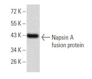 Napsin A Antibody (10C4B8) - Western Blotting - Image 358301 