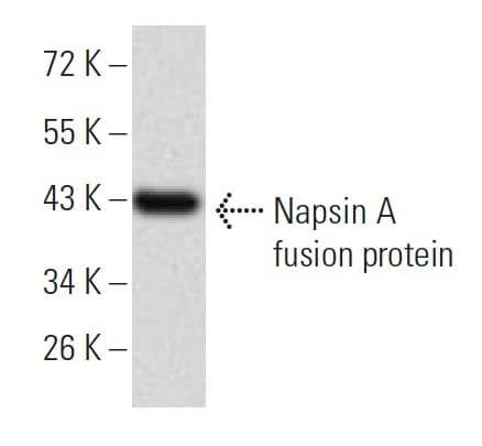 Napsin A抗体 (10C4B8) | SCBT - Santa Cruz Biotechnology