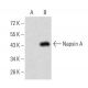 Napsin A Antibody (10C4B8) - Western Blotting - Image 358302