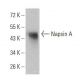 Napsin A Antibody (10C4B8) - Western Blotting - Image 358303 