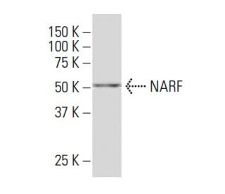 NARF Antibody (32-7) - Western Blotting - Image 34024