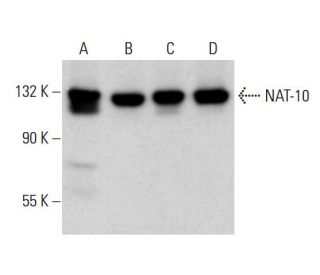 NAT-10 Antibody (C-10) - Western Blotting - Image 376086 