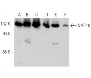 NAT-10 Antibody (D-11) - Western Blotting - Image 359376 