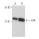 western blotting image from recommended NBK (H-1) monoclonal antibody replacement. Image 356155