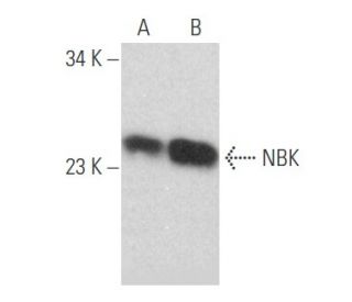 western blotting image from recommended NBK (H-1) monoclonal antibody replacement. Image 356155