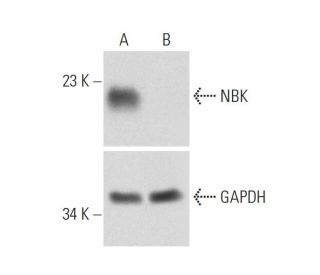 NBK CRISPR/Cas9 KO Plasmid (h): sc-401751. Western blot analysis of human NBK expression in empty vector control (A) and N